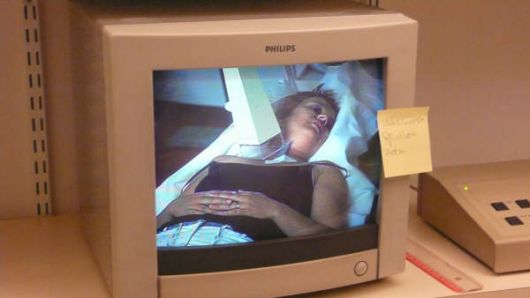 bestraling uitzaaiing in halslymfeklier